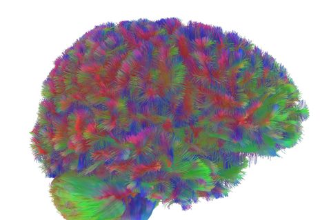 Sogenannte MRT-Diffusionsscans lassen deutliche Unterschiede der Hirnstruktur abhängig vom Alter erkennen. Foto: Dr Alexa Mousle