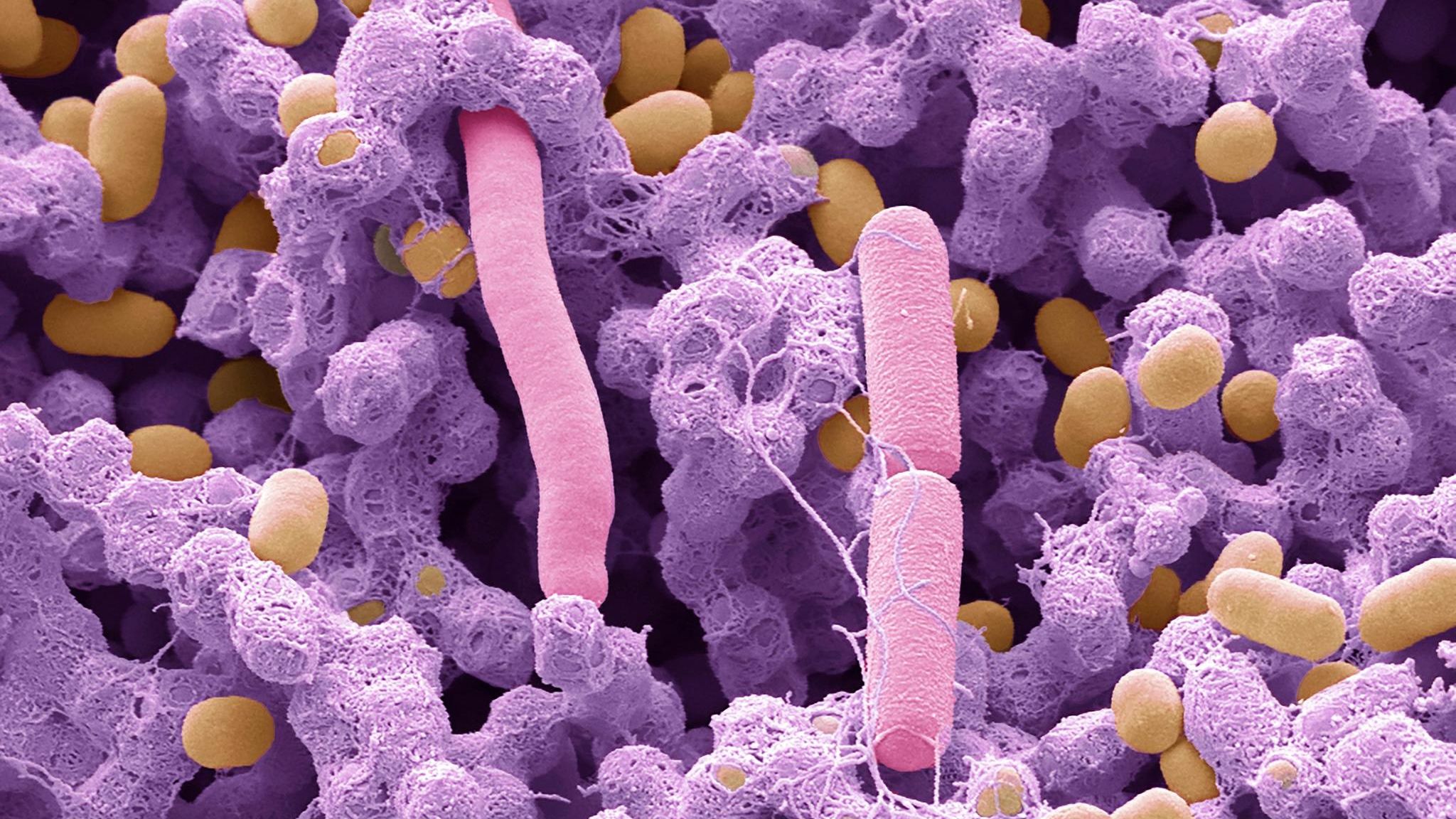 Mikroskopische Aufnahme des Mikrobioms eines Babys