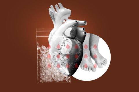 Illustration: Herz, geschwollene Füße und ein Tütchen mit Drogen