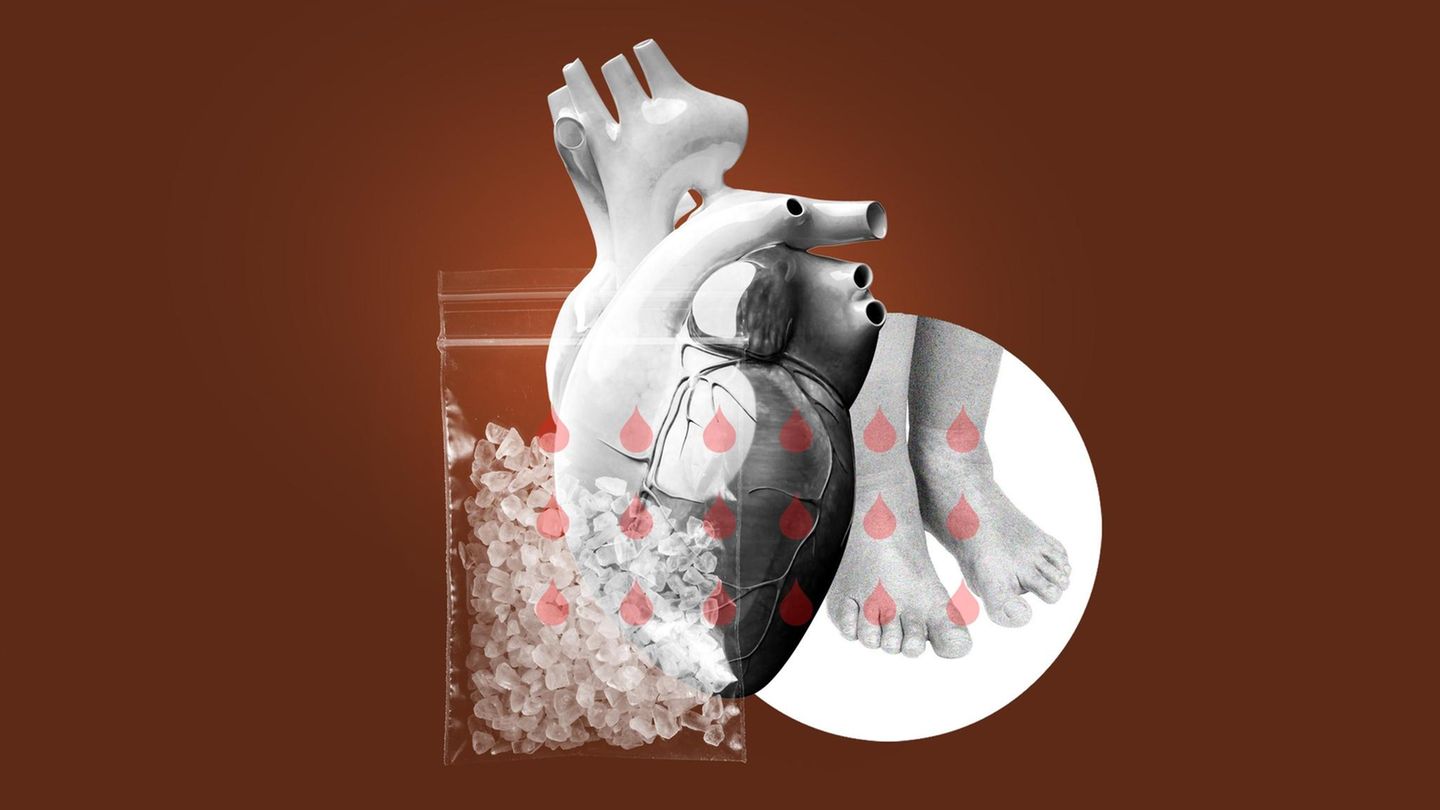 Illustration: Herz, geschwollene Füße und ein Tütchen mit Drogen