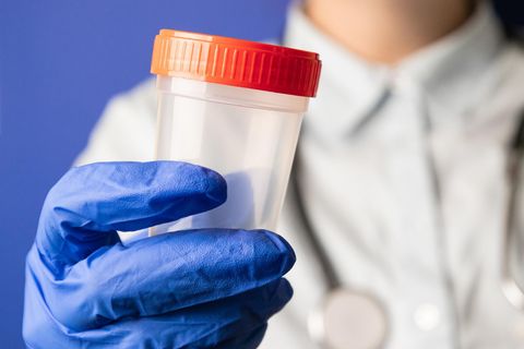 Mensch mit Arztkittel und Handschuhen hält einen Probenbecher. Symbolbild Sperma-Spende