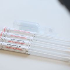 Die beteiligten Kliniken erhalten Sets für die vertrauliche Spurensicherung und schicken anschließend Proben und Beweismittel na