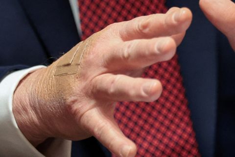 Nahaufnahme von Donald Trumps rechter Hand mit einem Pflaster auf dem Handrücken
