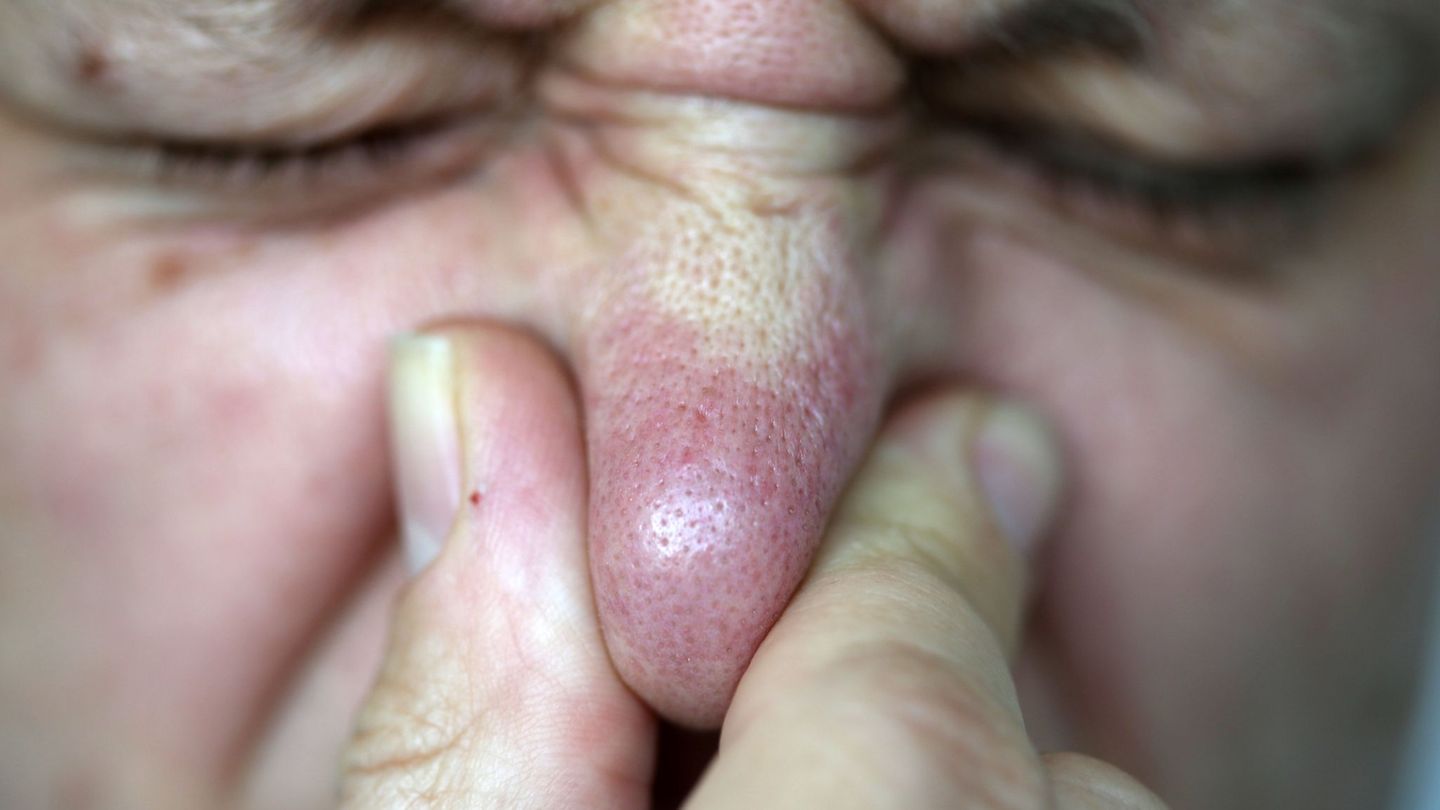 Die Abgasuntersuchung ergab laut dem Landratsamt, dass eine Gesundheitsgefährdung nicht besteht. (Symbolbild) Foto: Oliver Berg/