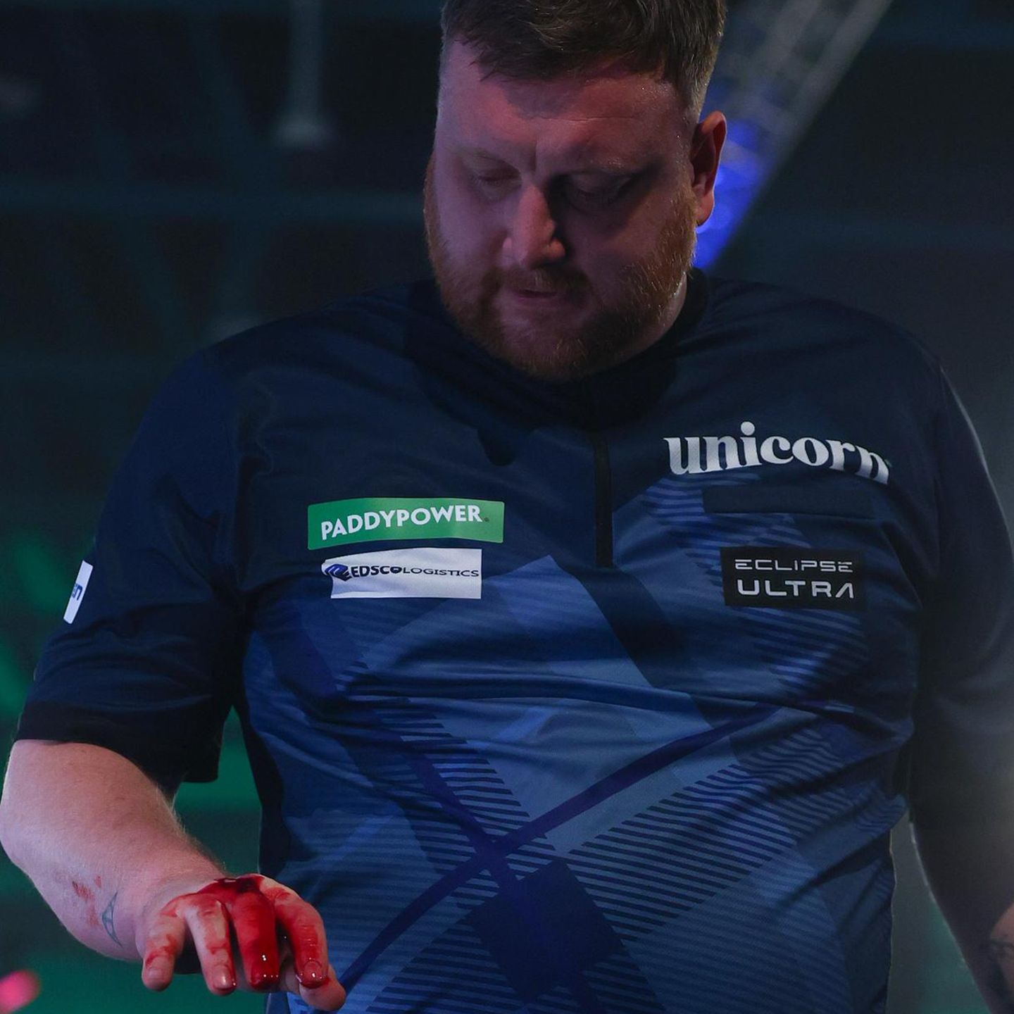 Cameron Menzies hat seine Hand in einem Wutanfall übel zugerichtet