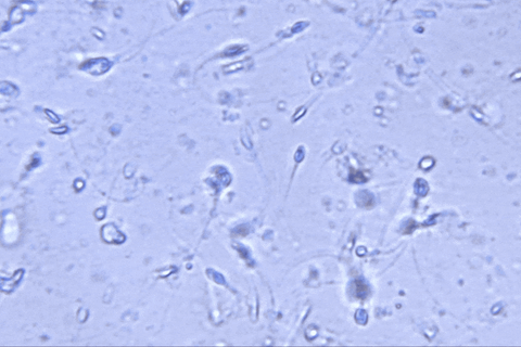 Vasektomie: Spermien unter dem Mikroskop