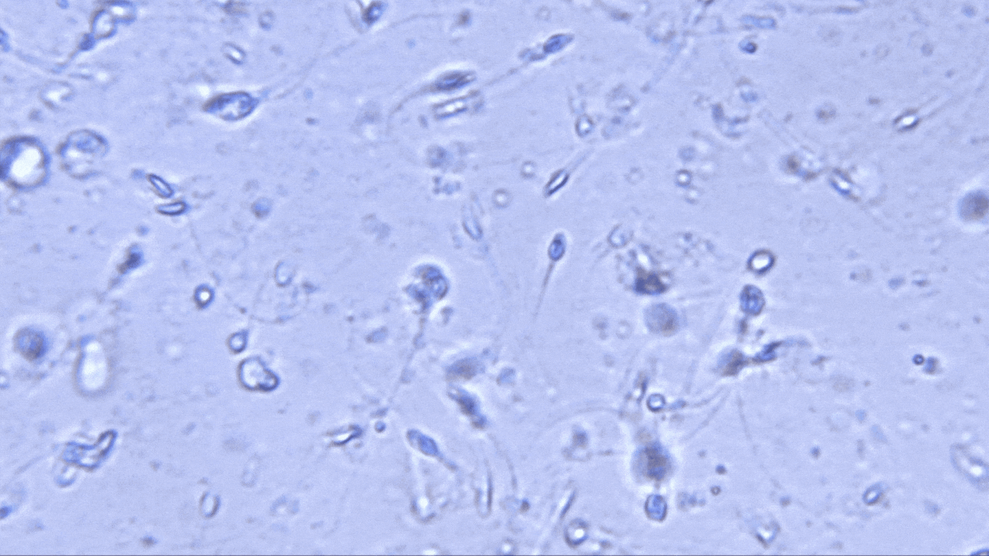 Vasektomie: Spermien unter dem Mikroskop