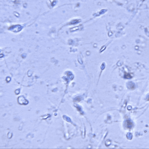Vasektomie: Spermien unter dem Mikroskop