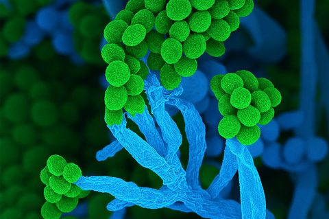 Penicillium bedeutet auf Lateinisch "kleiner Pinsel", weil die Zellketten mit Sporen am Ende so ähnlich aussehen (Handout) Foto: