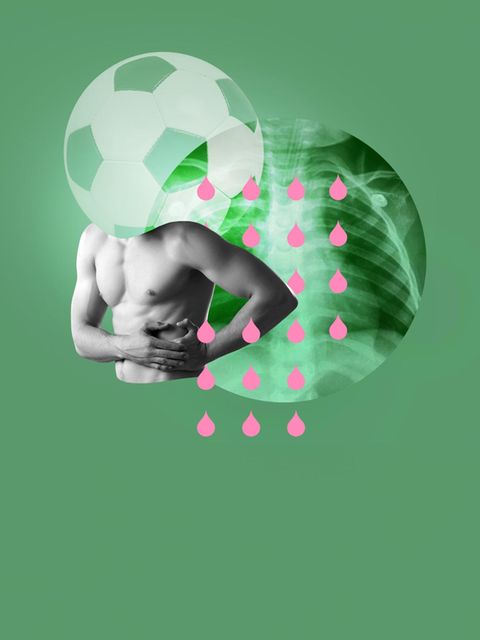 Schmerzen: Ein oberkörperfreier Körper vor einer Röntgenaufnahme und einem Fußball