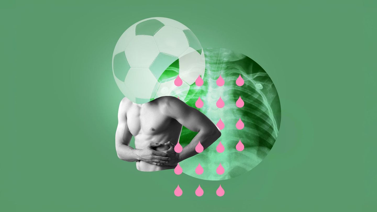 Schmerzen: Ein oberkörperfreier Körper vor einer Röntgenaufnahme und einem Fußball