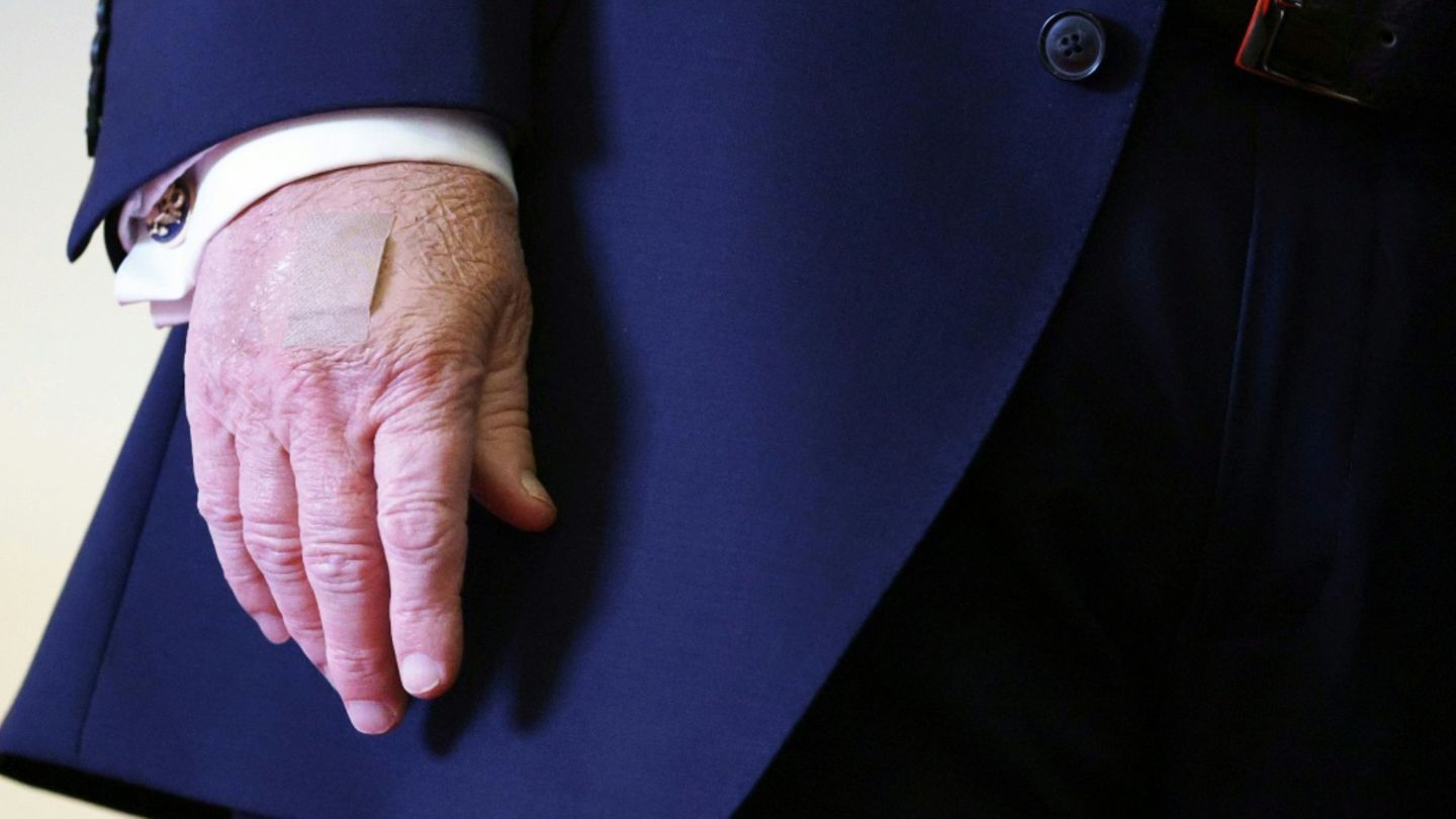 Trumps rechte Hand mit Pflaster