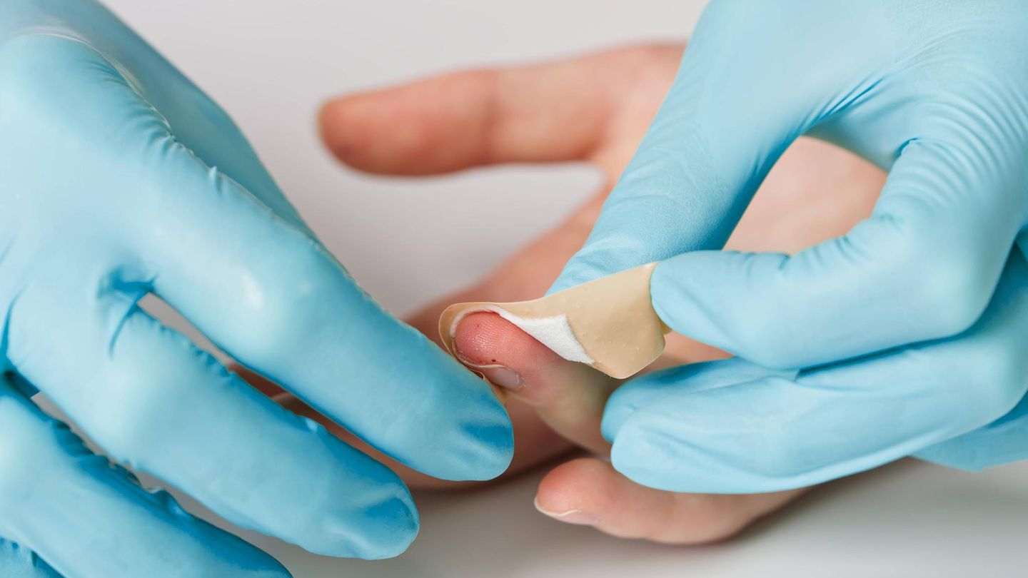 Entzündungen Arzt versorgt Wunde am Finger mit Pflaster