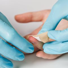 Entzündungen Arzt versorgt Wunde am Finger mit Pflaster