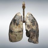 Bild der Lunge eines starken Rauchers