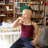 Ein Kind, das druch eine Chemotherapie die Haare verloren hat