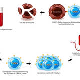 CAR-T – Kampf mit Hilfe der Genetik  Die CAR-T-Zelltherapie nutzt ebenfalls das körpereigene Immunsystem, geht jedoch einen Schritt weiter: Dem Patienten wird Blut abgenommen, die darin enthaltenen T-Zellen werden gentechnisch so verändert, dass sie gezielt ein Merkmal der Krebszellen erkennen. Anschließend werden sie dem Patienten wieder injiziert und wirken wie eine maßgeschneiderte Waffe gegen den Tumor. Besonders bei bestimmten Leukämien und Lymphomen sind damit sehr hohe, teils dauerhafte Behandlungserfolge möglich.