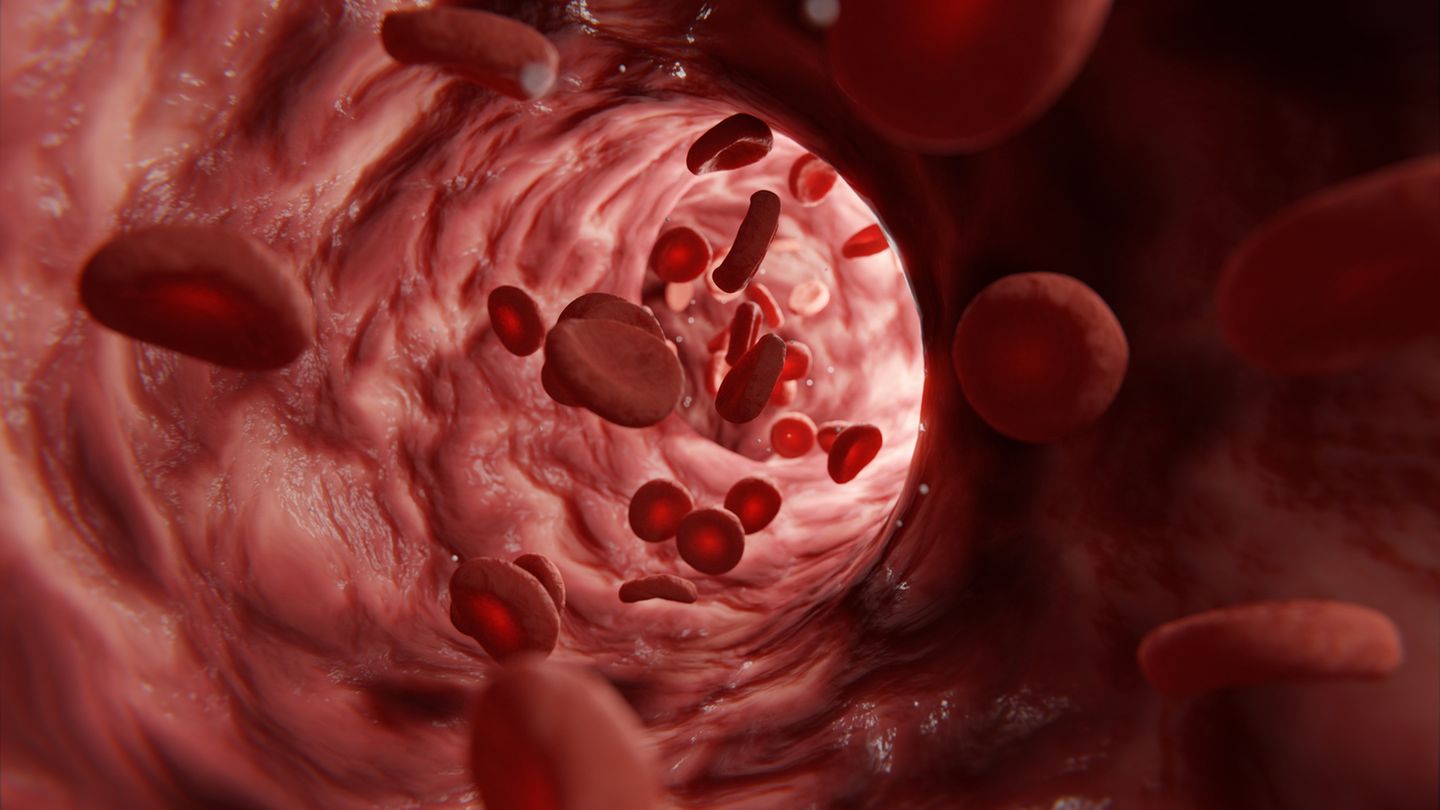 Wenn Blutgefäße entarten – das epitheloide Hämangioendotheliom  Das epitheloide Hämangioendotheliom ist ein rätselhafter Gefäßtumor, der Leber, Lunge oder Knochen betreffen kann. Lange bleibt er symptomlos, später treten Schmerzen oder Atemnot auf. Manche Verläufe sind harmlos, andere hochaggressiv. Seine Seltenheit erklärt sich durch die Stabilität der Ursprungszellen: Endothelzellen besitzen starke Reparaturmechanismen und teilen sich wenig. Nur sehr spezifische genetische Veränderungen können diese Schutzmechanismen überwinden – ein biologischer Zufall von extremer Unwahrscheinlichkeit.