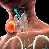 Grafik der Schilddrüse und des Halsbereiches eines Menschen