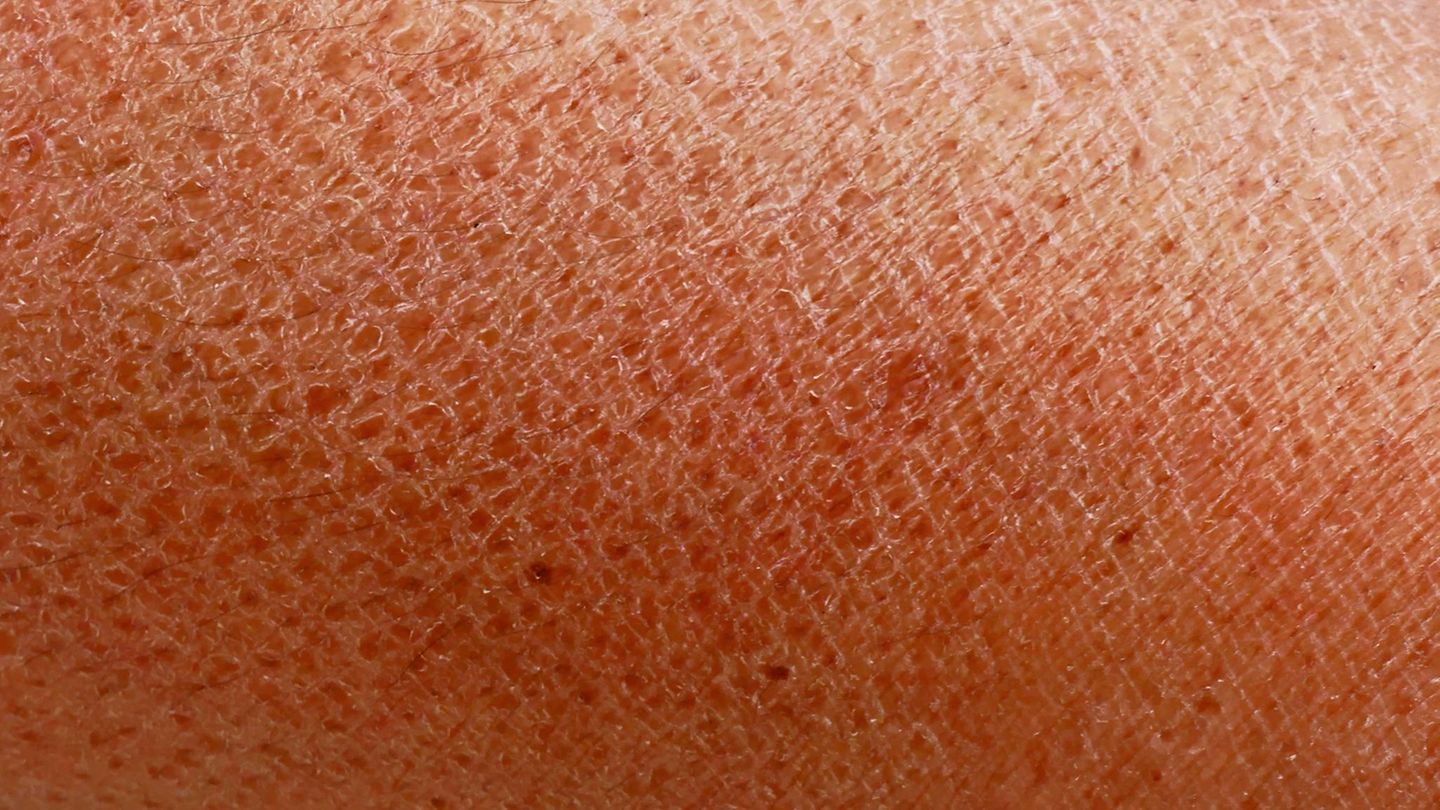 Nahaufnahme der menschlichen Haut