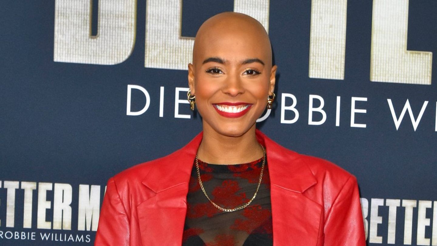 Sharon Battiste trägt seit 2022 eine Glatze. Bereits seit der Kindheit leidet sie an kreisrundem Haarausfall (Alopecia areata)