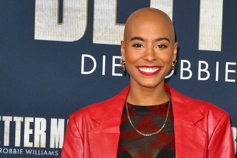 Sharon Battiste trägt seit 2022 eine Glatze. Bereits seit der Kindheit leidet sie an kreisrundem Haarausfall (Alopecia areata)