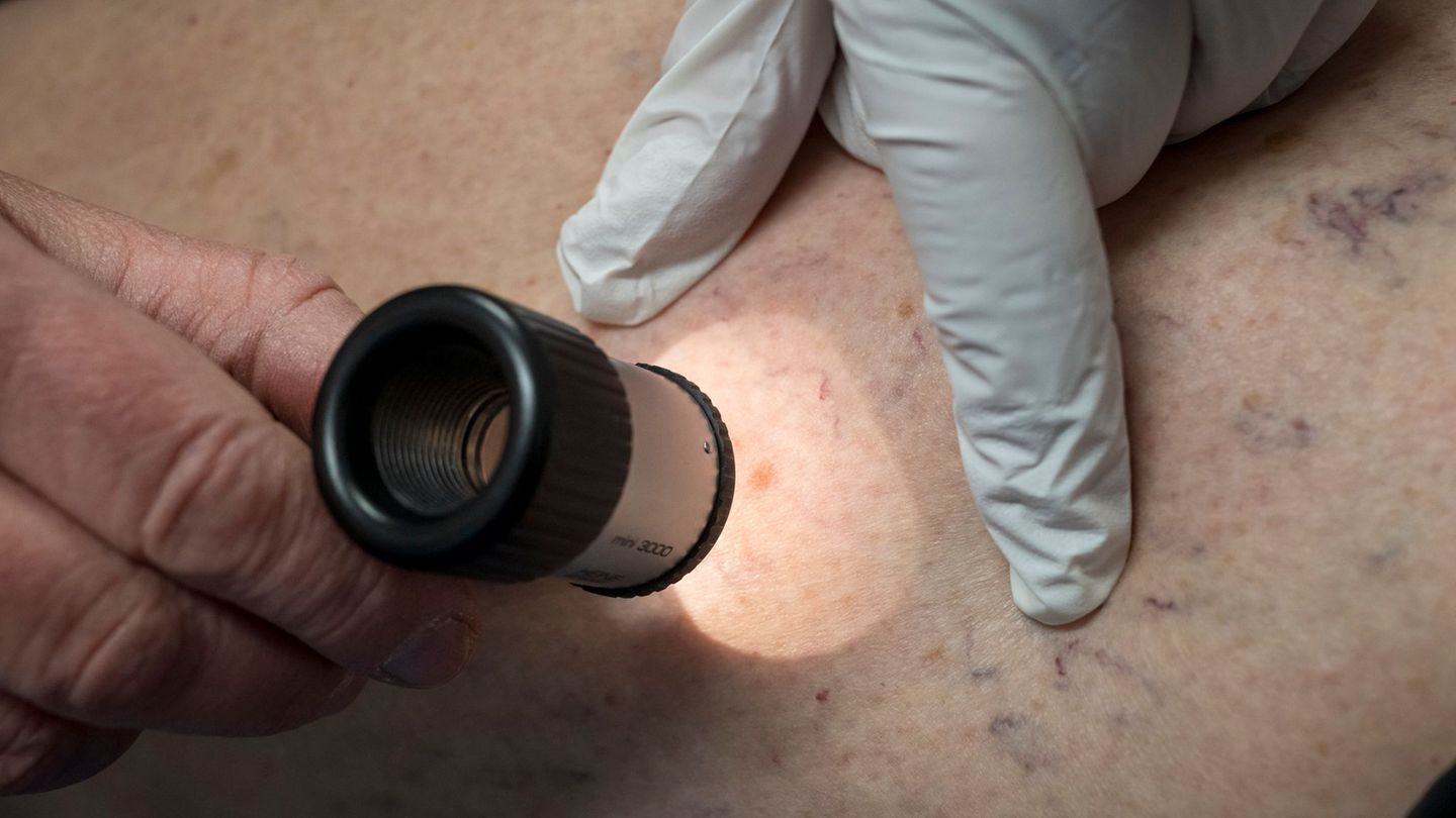 In Sachsen-Anhalt gibt es eine Anlaufstelle für Menschen mit seltenen Krankheiten. (Symbolbild) Foto: Peter Kneffel/dpa