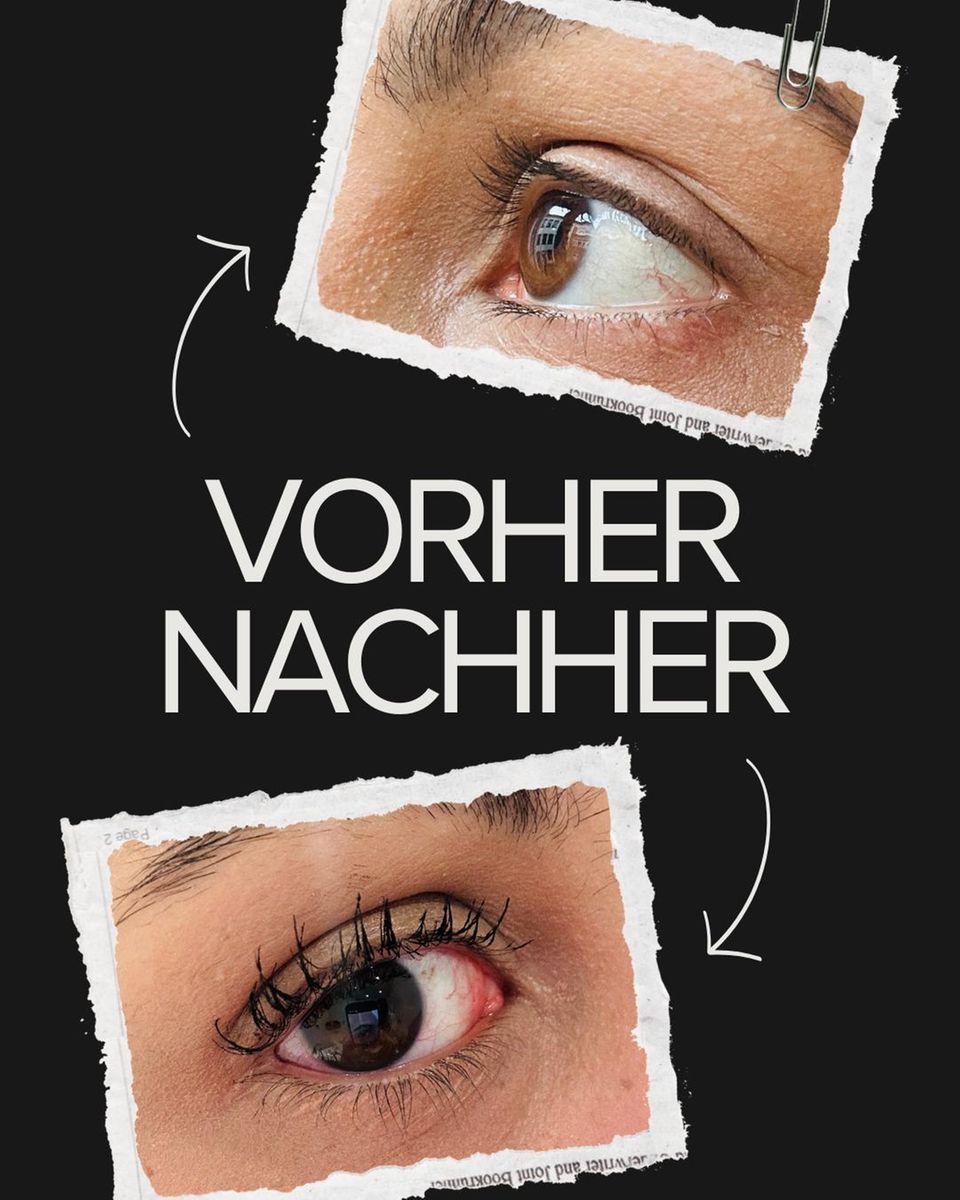 Vorher-Nachher Foto Kess
