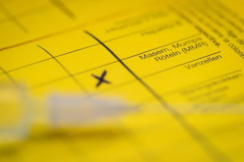 Bei Masern zeigt sich erst oft Fieber, bevor später ein Hautausschlag dazukommt. (Symbolbild) Foto: Friso Gentsch/dpa