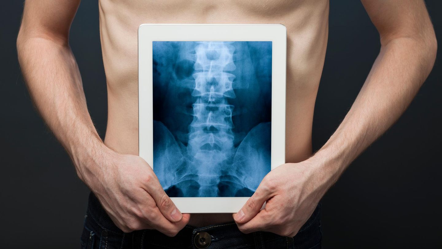 Ein Mann hält ein Röntgenbild von seinem Rücken vor seinen Bauch