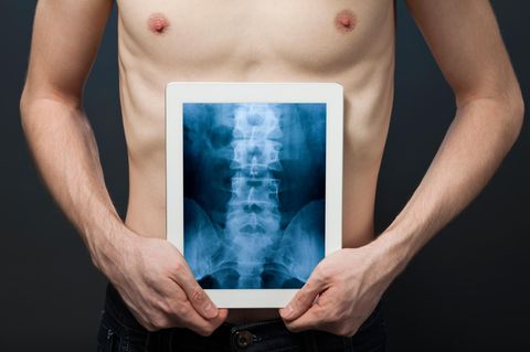 Ein Mann hält ein Röntgenbild von seinem Rücken vor seinen Bauch