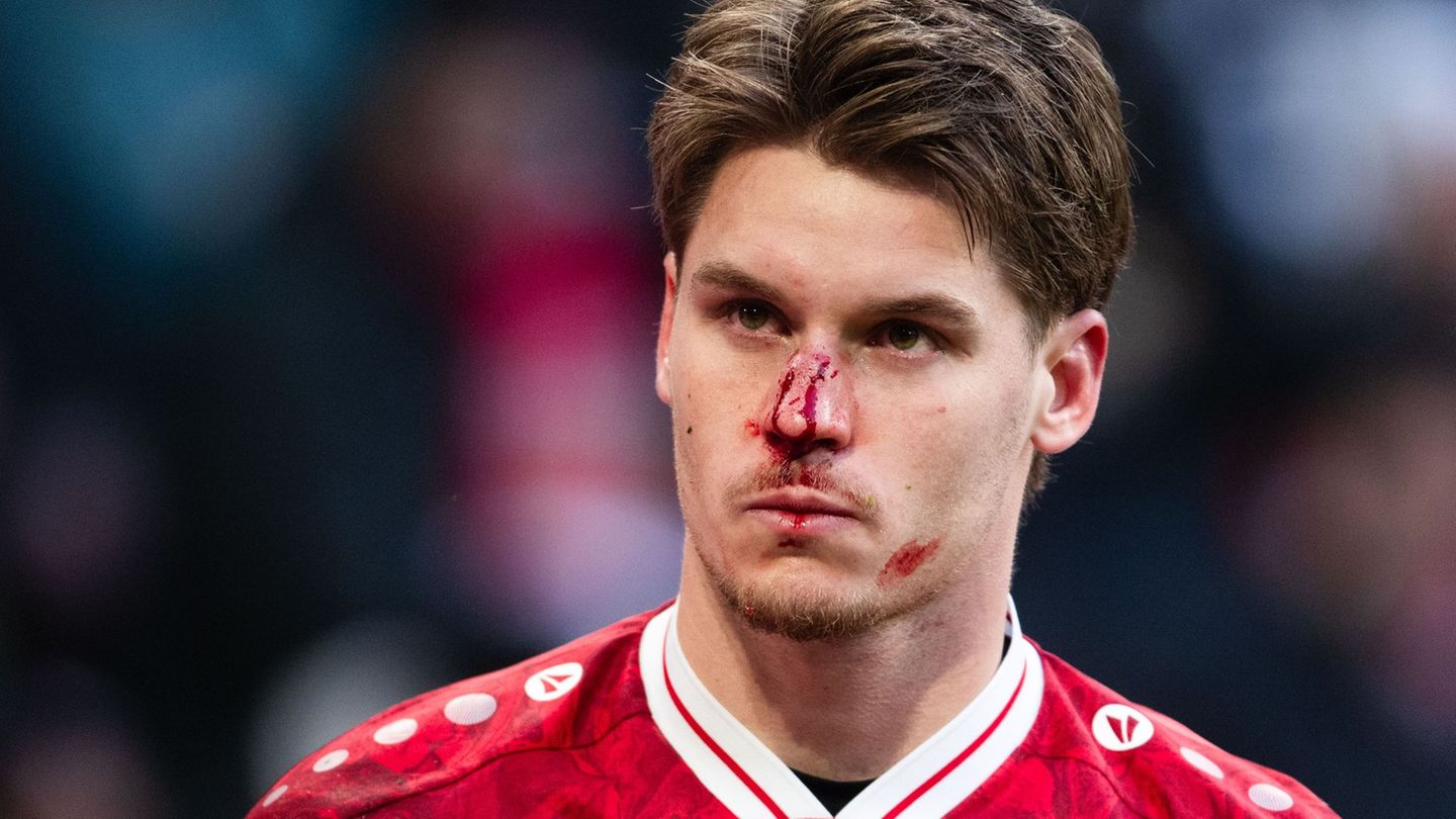 Ramon Hendriks brach sich die Nase - kann mit einer Maske aber voraussichtlich spielen. (Archivbild) Foto: Marius Becker/dpa