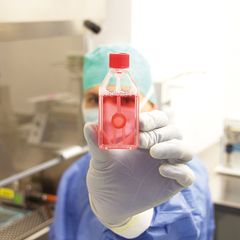 Gewebespende: Eine Person mit Mundschutz und Laborkleidung hält eine Flasche mit rötlicher Flüssigkeit hoch