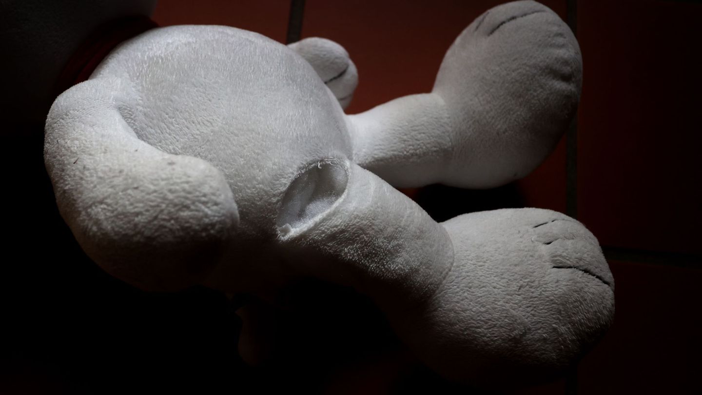 Ob das Kind bleibende Schäden hat, ist noch ungewiss. (Symbolbild) Foto: Karl-Josef Hildenbrand/dpa