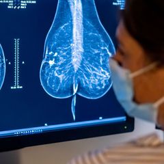 2023 wurden rund eine halbe Million Menschen in Deutschland mit Krebs diagnostiziert