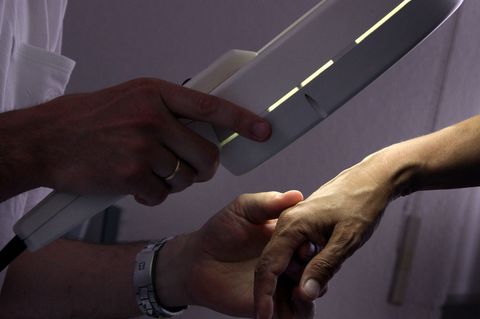 Die Teilnahme an der Hautkrebs-Vorsorge ist in MV gewachsen. (Symbolbild) Foto: Karl-Josef Hildenbrand/dpa