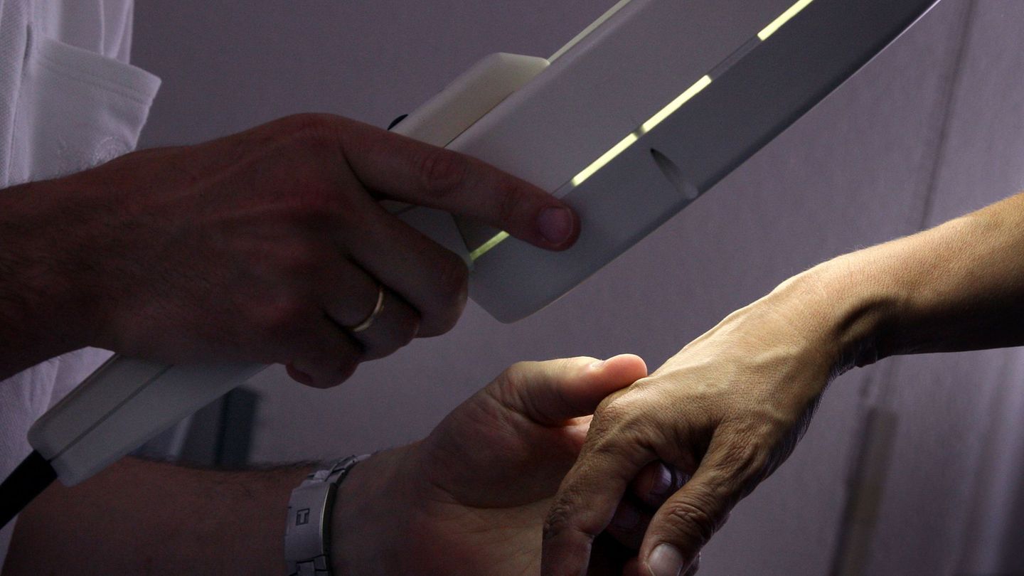 Die Teilnahme an der Hautkrebs-Vorsorge ist in MV gewachsen. (Symbolbild) Foto: Karl-Josef Hildenbrand/dpa