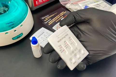 Mit handlichen Tests können Substanzen auf ihre Zusammensetzung getestet werden - wie hier bei einem Drug-Checking-Projekt der S