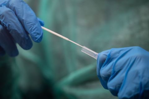 In Hannover steht ein 27-Jähriger vor Gericht, der eine überhöhte Anzahl Corona-Tests abgerechnet und einen Schaden von rund 1,6