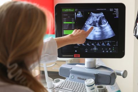 Auf dem Ultraschallbild ist laut der Ärztin zu sehen, dass Jasmin Schmidt wieder Zwillinge bekommt