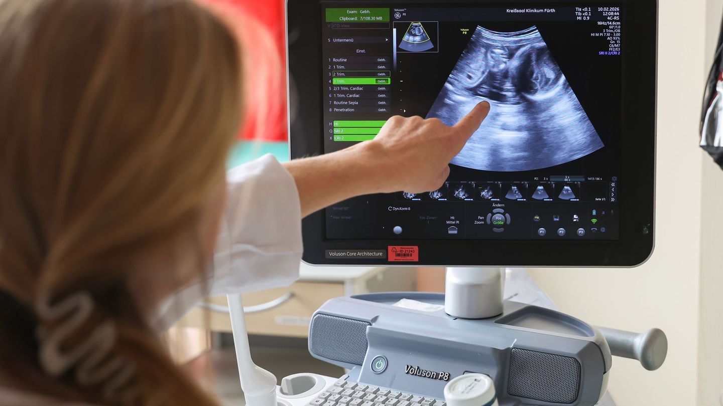 Auf dem Ultraschallbild ist laut der Ärztin zu sehen, dass Jasmin Schmidt wieder Zwillinge bekommt