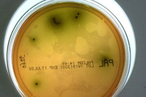 Nahaufnahme eines Listerienstamms in einem Labor
