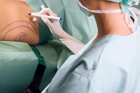 Ausgezeichnete Ärzte im Bereich Liposuktion