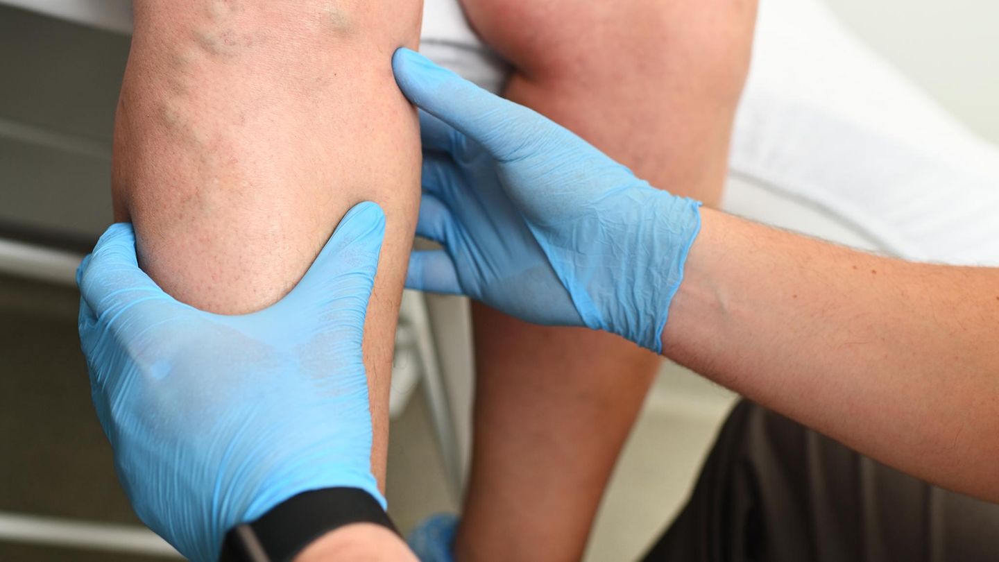 Ausgezeichnete Ärzte im Bereich Venenerkrankungen