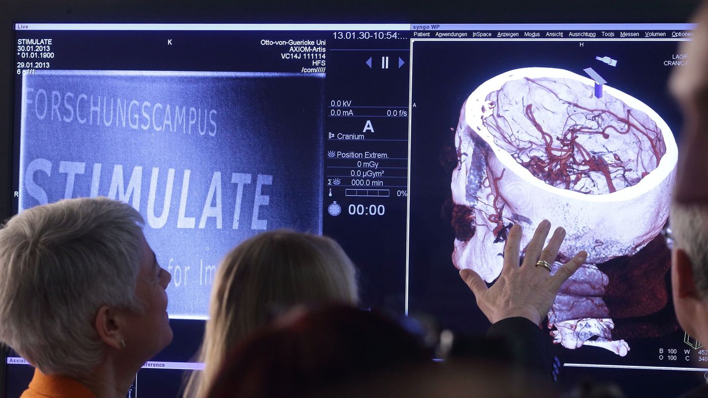 Auch Forschungsprojekte am Medizintechnik-Campus der Universität Magdeburg wurden wieder mit knapp zehn Millionen Euro gefördert