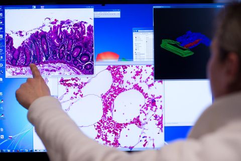 Die Diagnosen von Darmkrebs gehen seit 2020 in Rheinland-Pfalz zurück. (Archivbild) Foto: Bernd von Jutrczenka/dpa