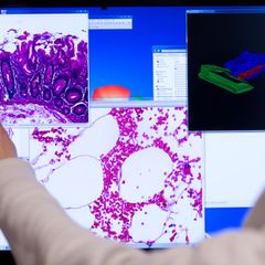 Die Diagnosen von Darmkrebs gehen seit 2020 in Rheinland-Pfalz zurück. (Archivbild) Foto: Bernd von Jutrczenka/dpa