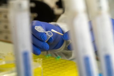 Kleinste Proben können dank DNA bei Ermittlungen eine große Rolle spielen. Foto: Stefan Sauer/dpa