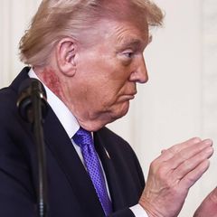 Am Hals von US-Präsident Donald Trump ist ein roter Fleck zu sehen