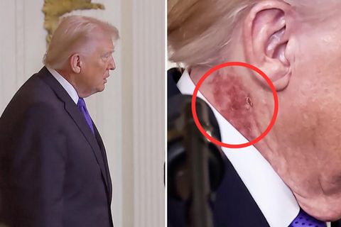 Roter Fleck an Trumps Hals - Weißes Haus äußert sich vage